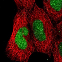 GALNTL1 Antibody, Novus Biologicals 25 &mu;L, Unlabeled:Antibodies, Polyclonal
